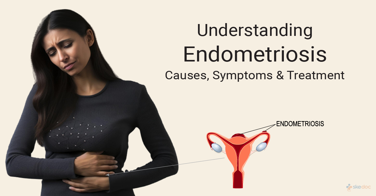 Endometriosis and Menstruation: Symptoms, Risks, and Effective Treatment Options